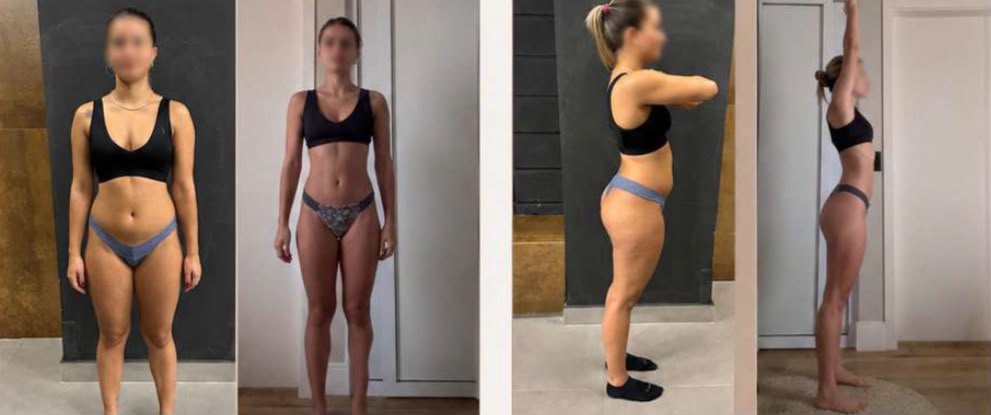 Registros fotográficos do acompanhamento de Giovanna, em quatro ângulos